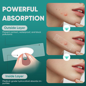 kindshine translucent edge detail illustrating secure adhesion and low profile