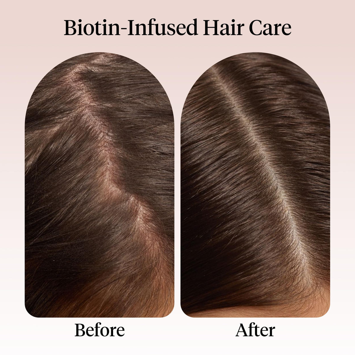 Applying Kitsch oil to scalp to nourish roots and soothe skin