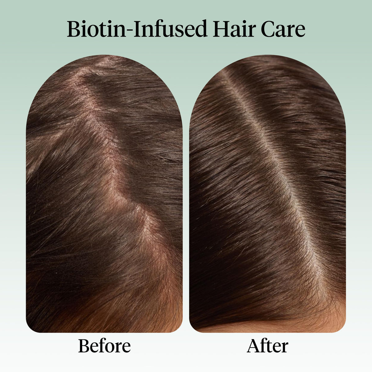 Kitsch scalp application in hand showing dropper at roots, enables easy pre-wash massage