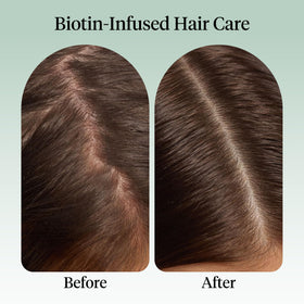 Kitsch scalp application in hand showing dropper at roots, enables easy pre-wash massage