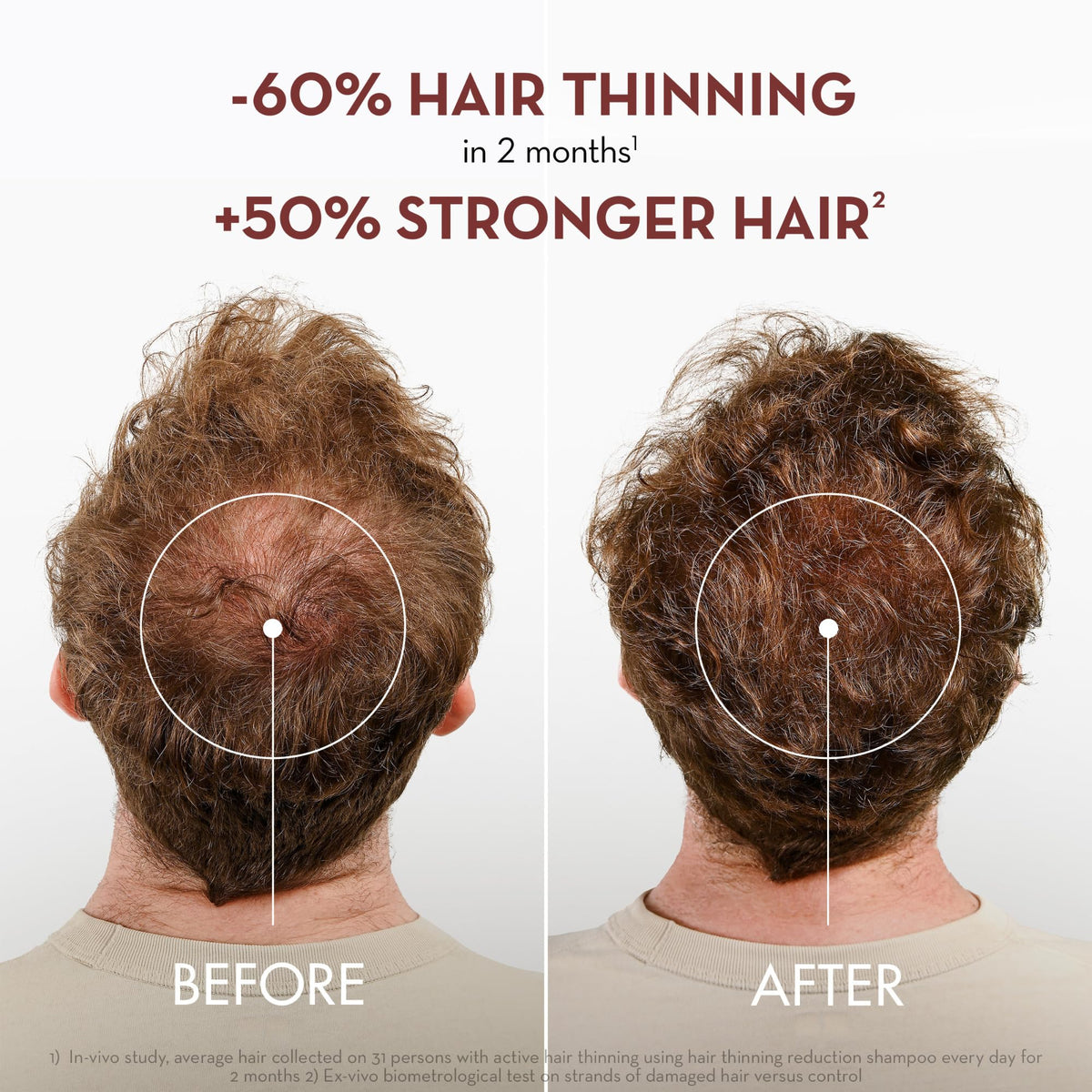 Klorane label close-up highlighting quinine and B vitamins for strengthening benefits