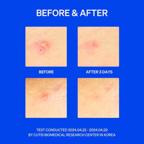 KNEMO SaniTouch two-step demonstration, helps hygienic easy placement