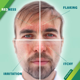 KOPA HAIKU applied to cheek showing gentle coverage and reduced visible flaking