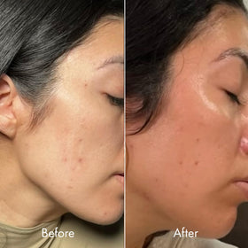 Kopari ingredient ceramides visual with leaves showing barrier-repairing benefit