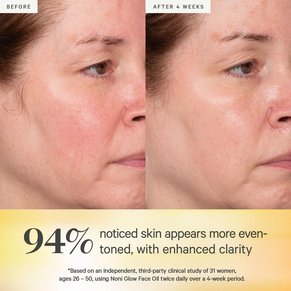 kora organics ingredient blend closeup highlighting noni and rosehip antioxidant benefits