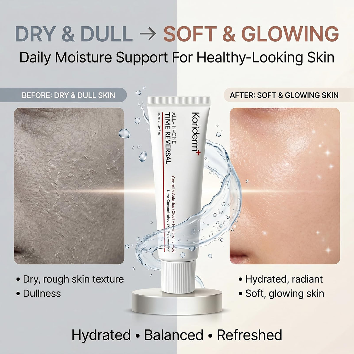 Koriderm label close-up highlighting active ingredients and clear directions