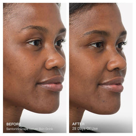KORRES dropper close-up releasing serum, demonstrating precise application