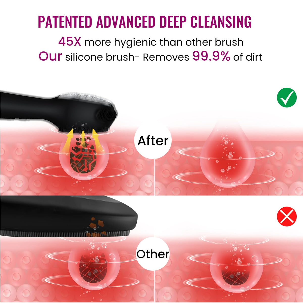 Kpyphm bristles closeup showing soft silicone texture that reduces irritation and bacteria