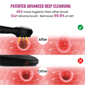 Kpyphm bristles closeup showing soft silicone texture that reduces irritation and bacteria