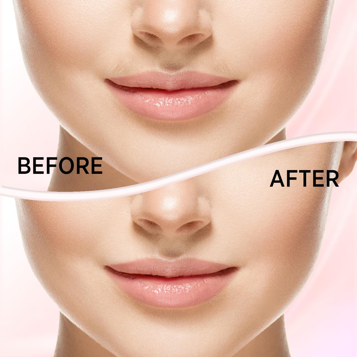 KRADAA LED light closeup illuminating fine facial hair for precise removal