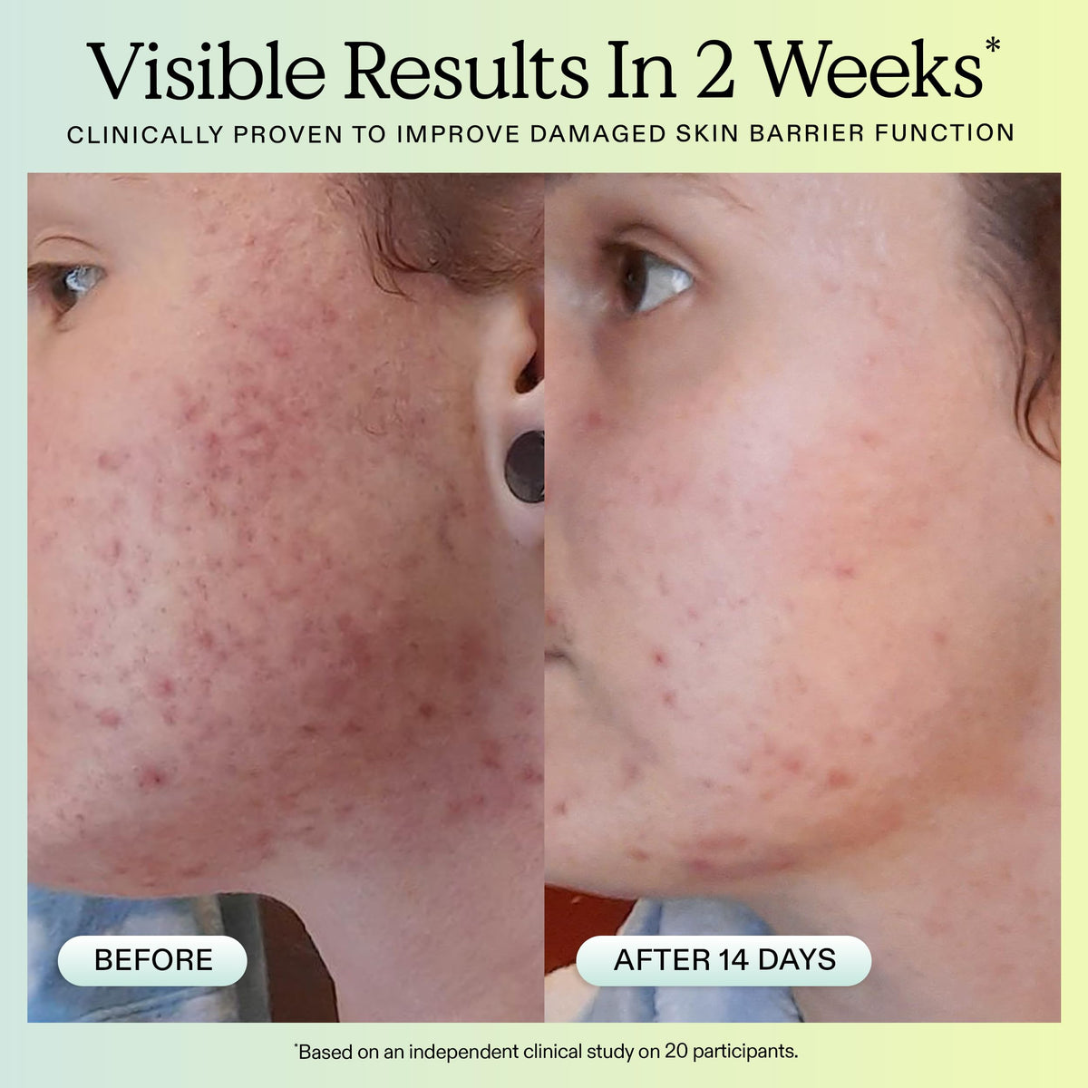KraveBeauty niacinamide illustration highlighting reduced redness and balanced hydration