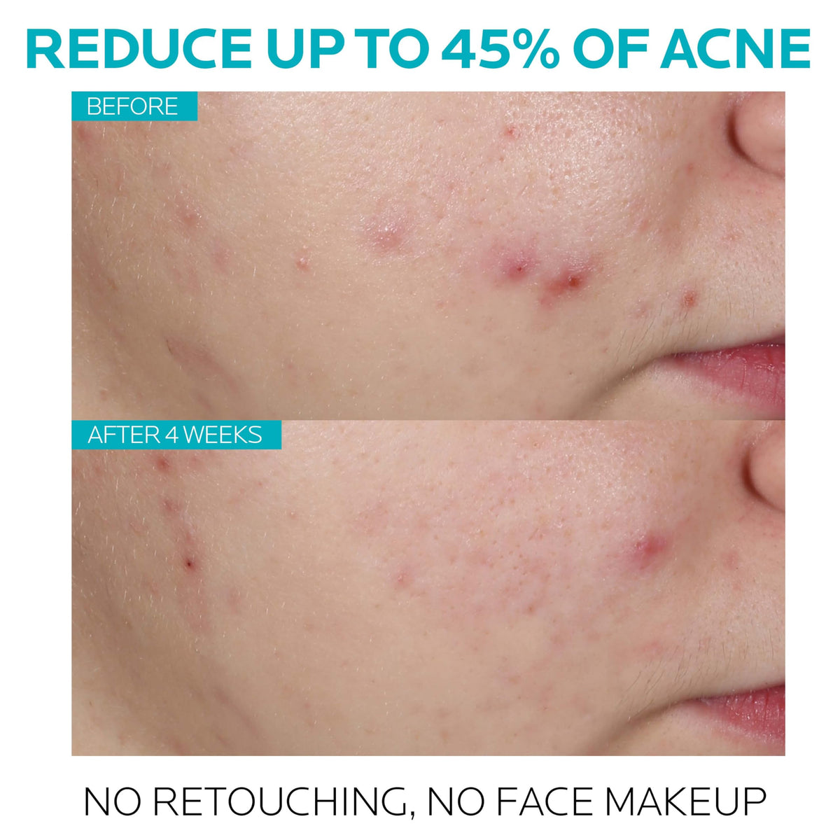 La Roche-Posay serum drop texture on fingertip demonstrating lightweight absorption