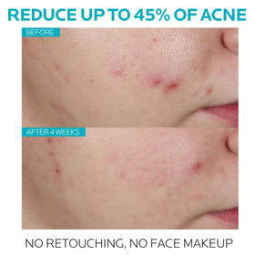 La Roche-Posay serum drop texture on fingertip demonstrating lightweight absorption