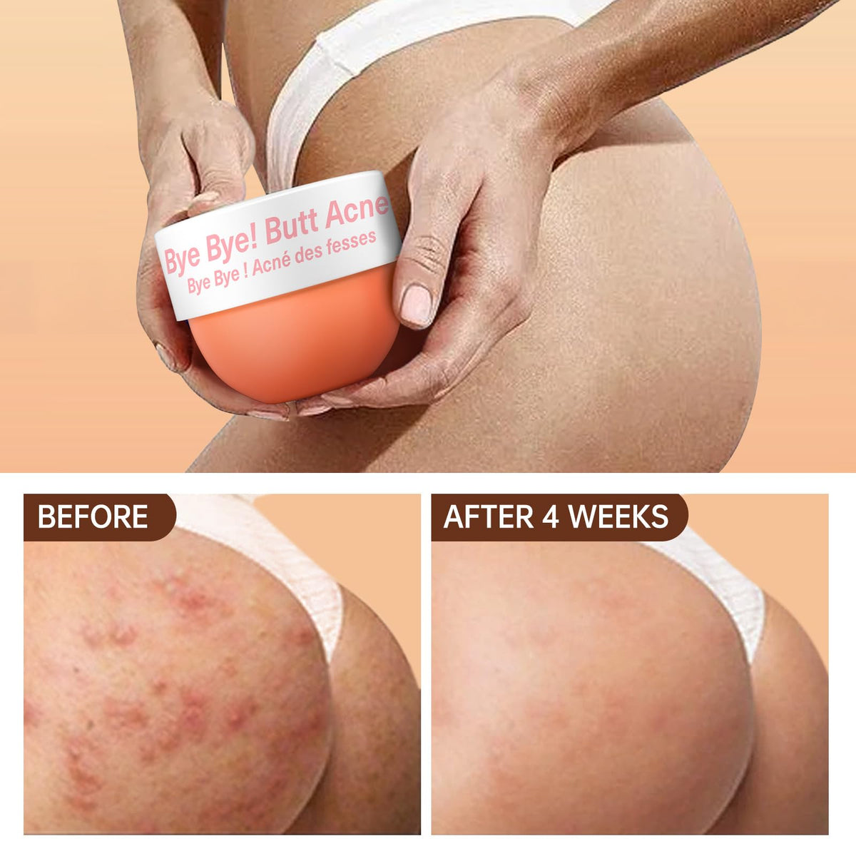 LA.PERSONAL application on buttocks demonstrating smooth, non-greasy finish