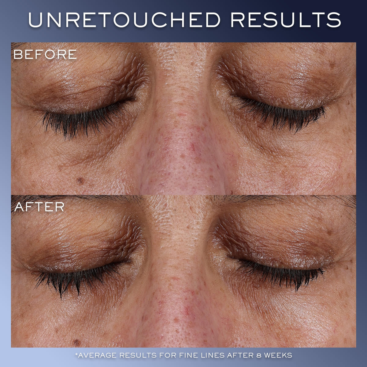 Lancôme Génifique ingredient display with hyaluronic acid showing moisture retention