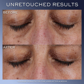 Lancôme Génifique ingredient display with hyaluronic acid showing moisture retention