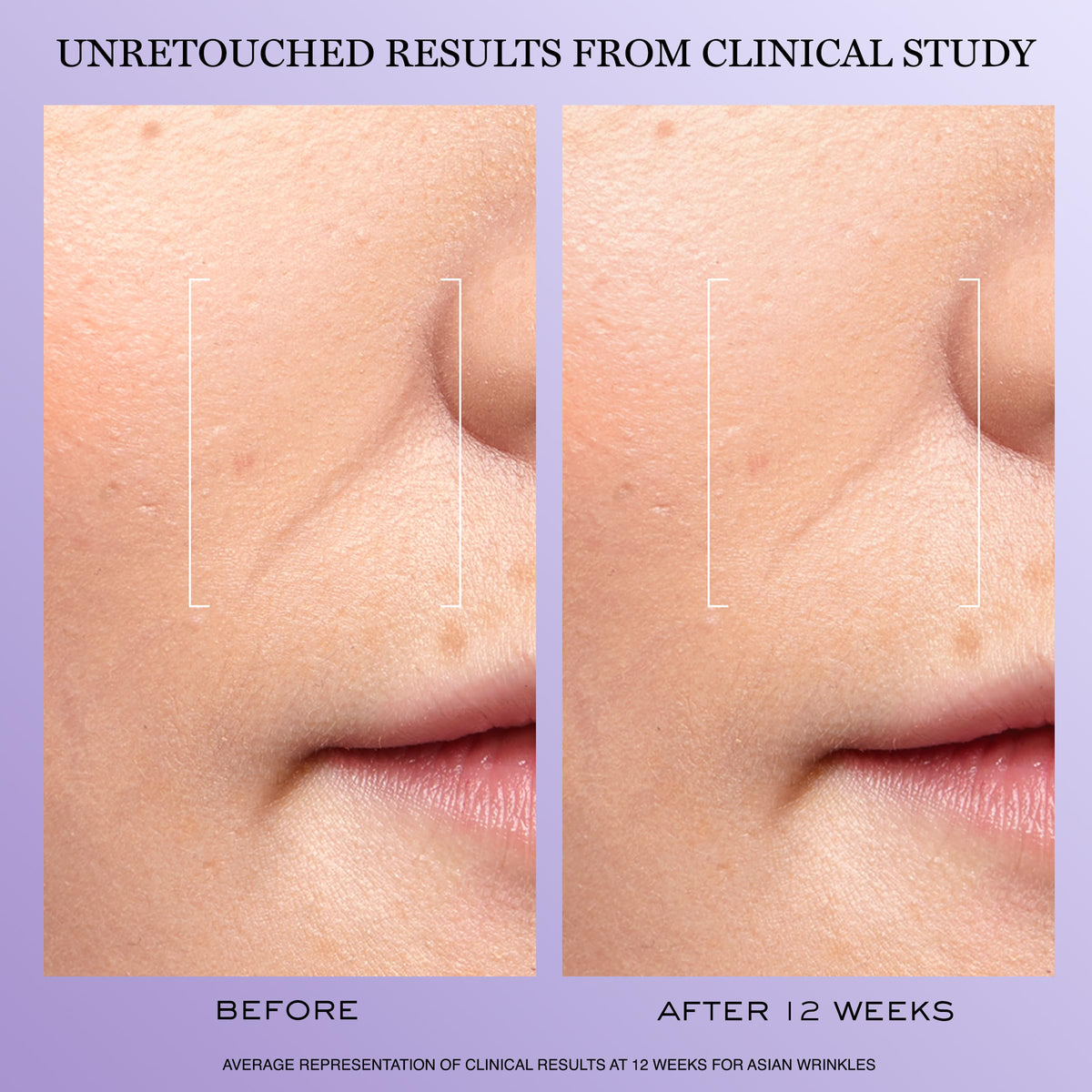 Lancôme texture of dispensed serum showing lightweight, fast-absorbing finish