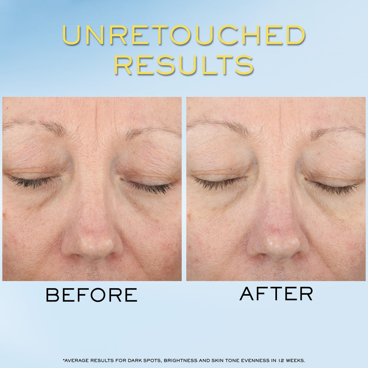 Lancôme ingredients display of niacinamide vitamin Cg and hyaluronic acid benefits