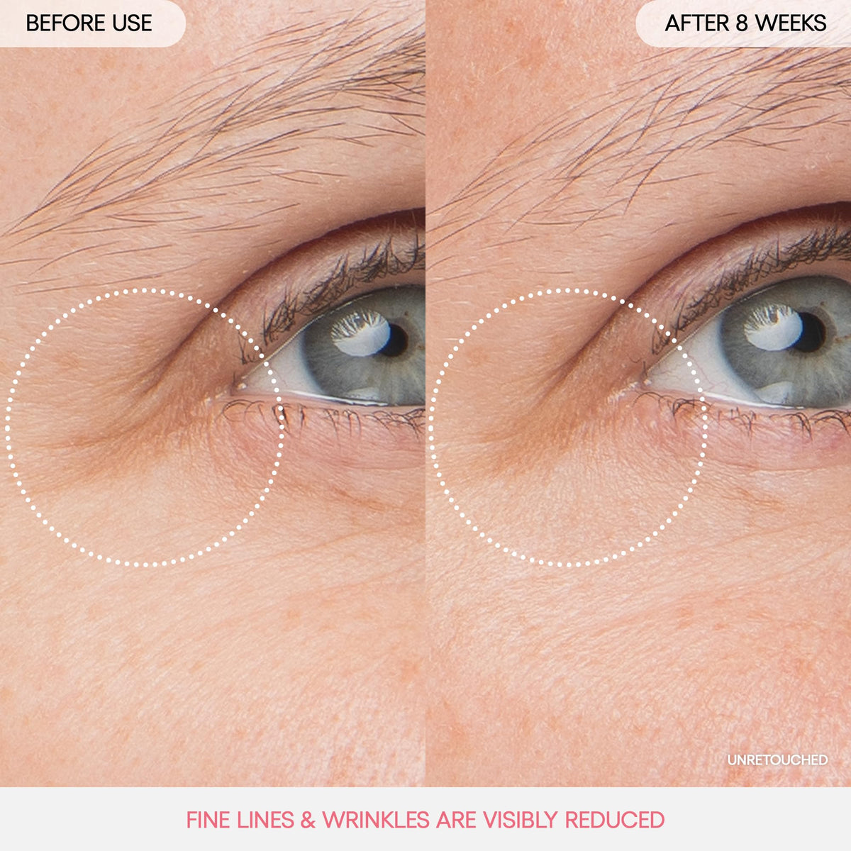 LANEIGE applied under-eye showing cooling layer to reduce puffiness