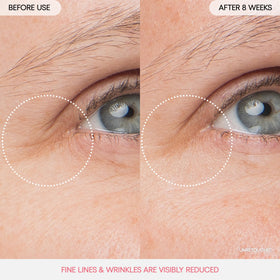 LANEIGE applied under-eye showing cooling layer to reduce puffiness