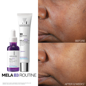 La Roche-Posay applying serum to cheek, demonstrates even coverage and fast absorption