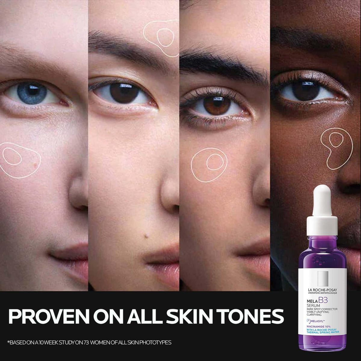 La Roche-Posay before and after comparison showing reduced dark spot appearance
