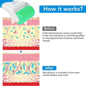 LATME ice roller used under eye to reduce puffiness and refresh skin