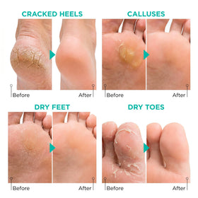 lavinso mask worn on foot showing fit up to men's size 11 benefit