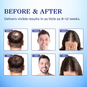 Lavtek applying spray to scalp demonstrating targeted hair support use