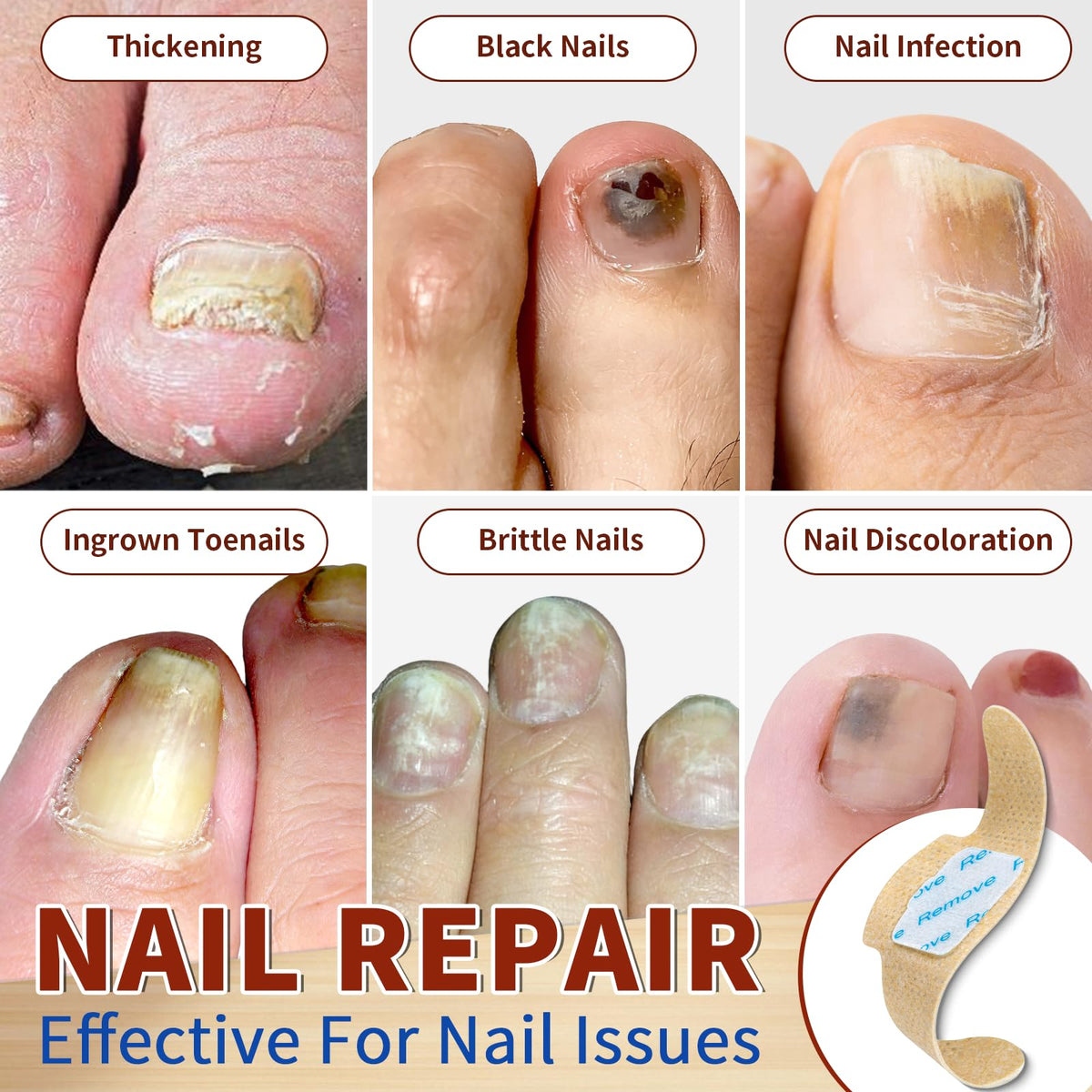 LAYOOYOO demonstration of applying patch to toenail for easy overnight use
