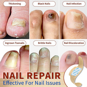 LAYOOYOO demonstration of applying patch to toenail for easy overnight use