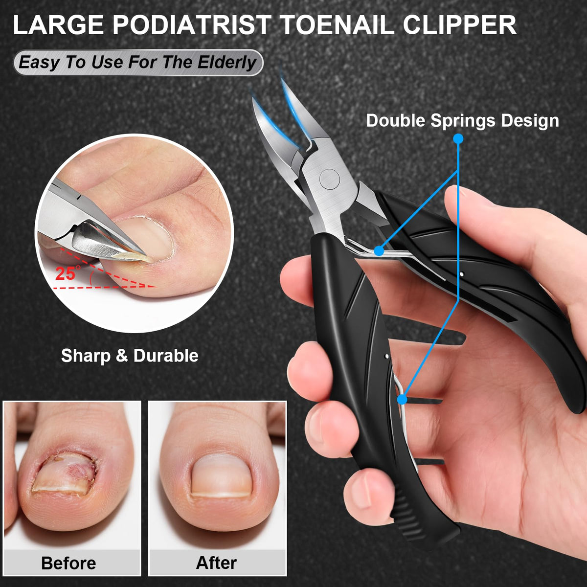 Leipple 45-degree slanted clipper detail for precise trimming of ingrown nail corners
