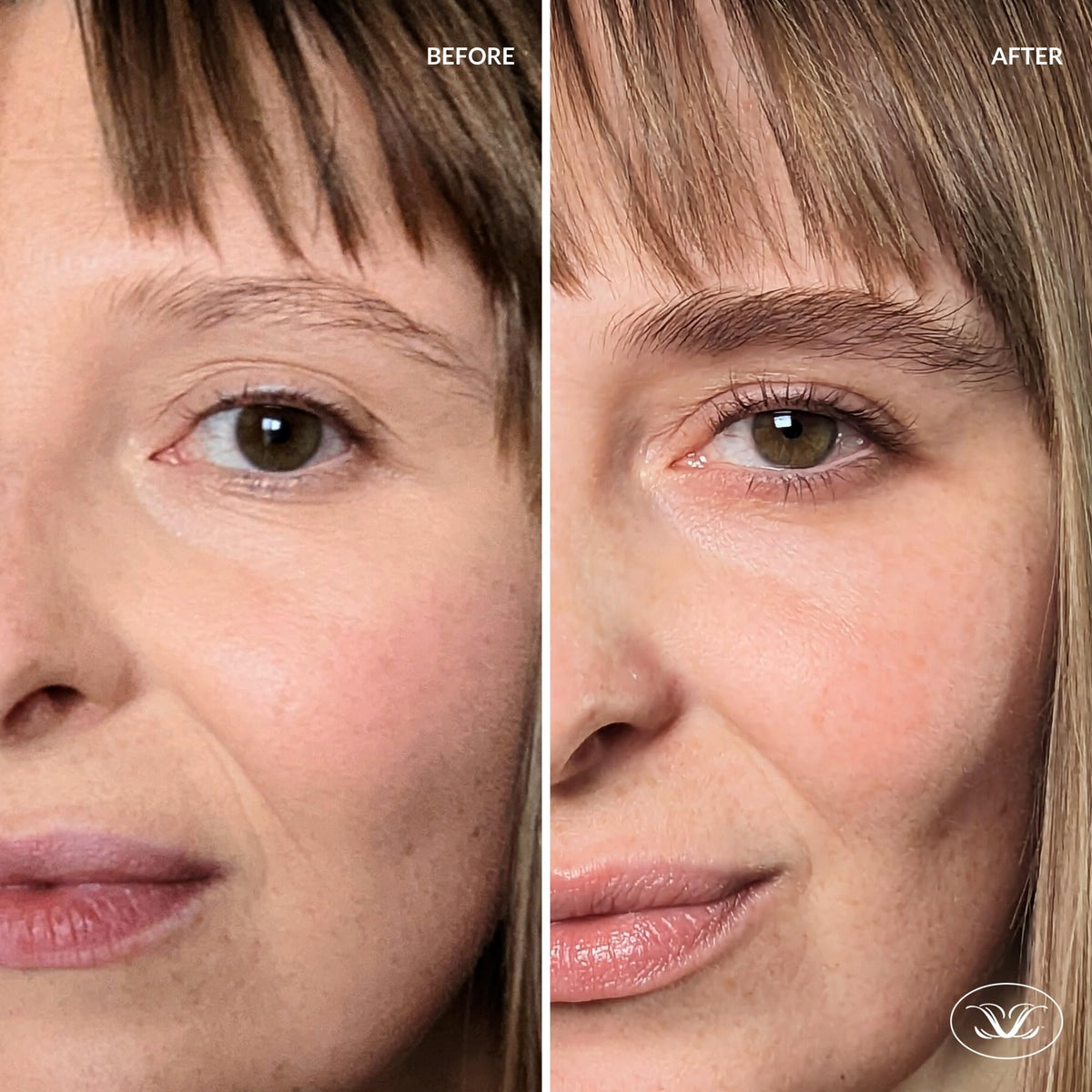 LiBrow 3mL tube beside ruler to illustrate 90-day supply and portability