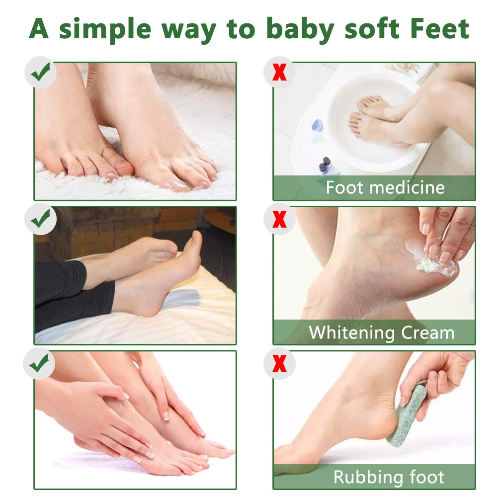 Liefiet before and after feet comparison showing softer, smoother heels