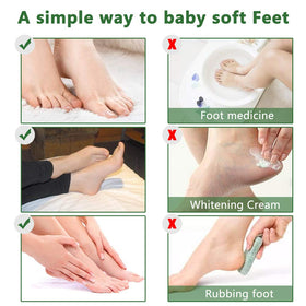 Liefiet before and after feet comparison showing softer, smoother heels