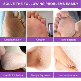 Close-up before and after heel showing Liefiet improved texture and softer skin