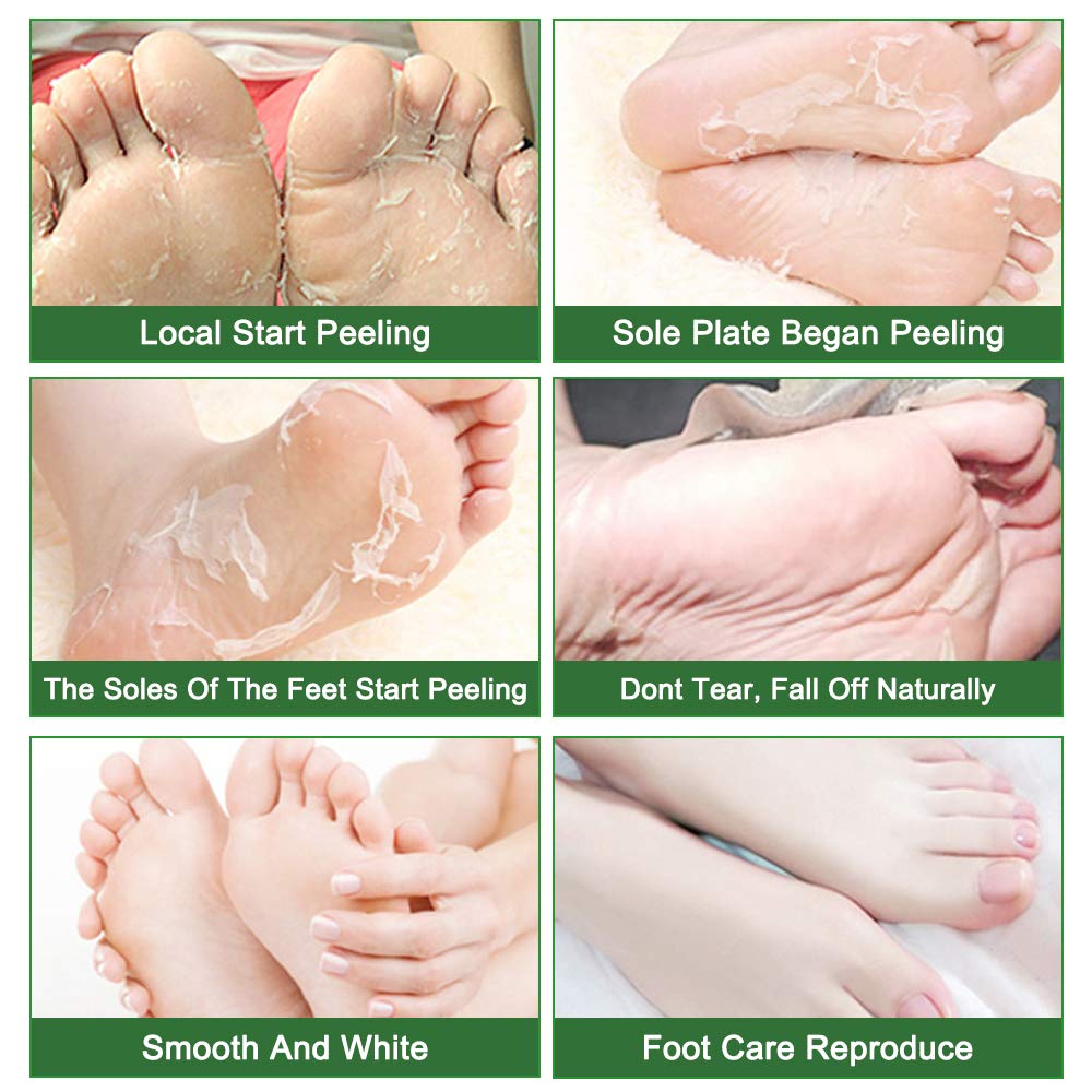 Liefiet single wearable foot sock opened to show prefilled active solution