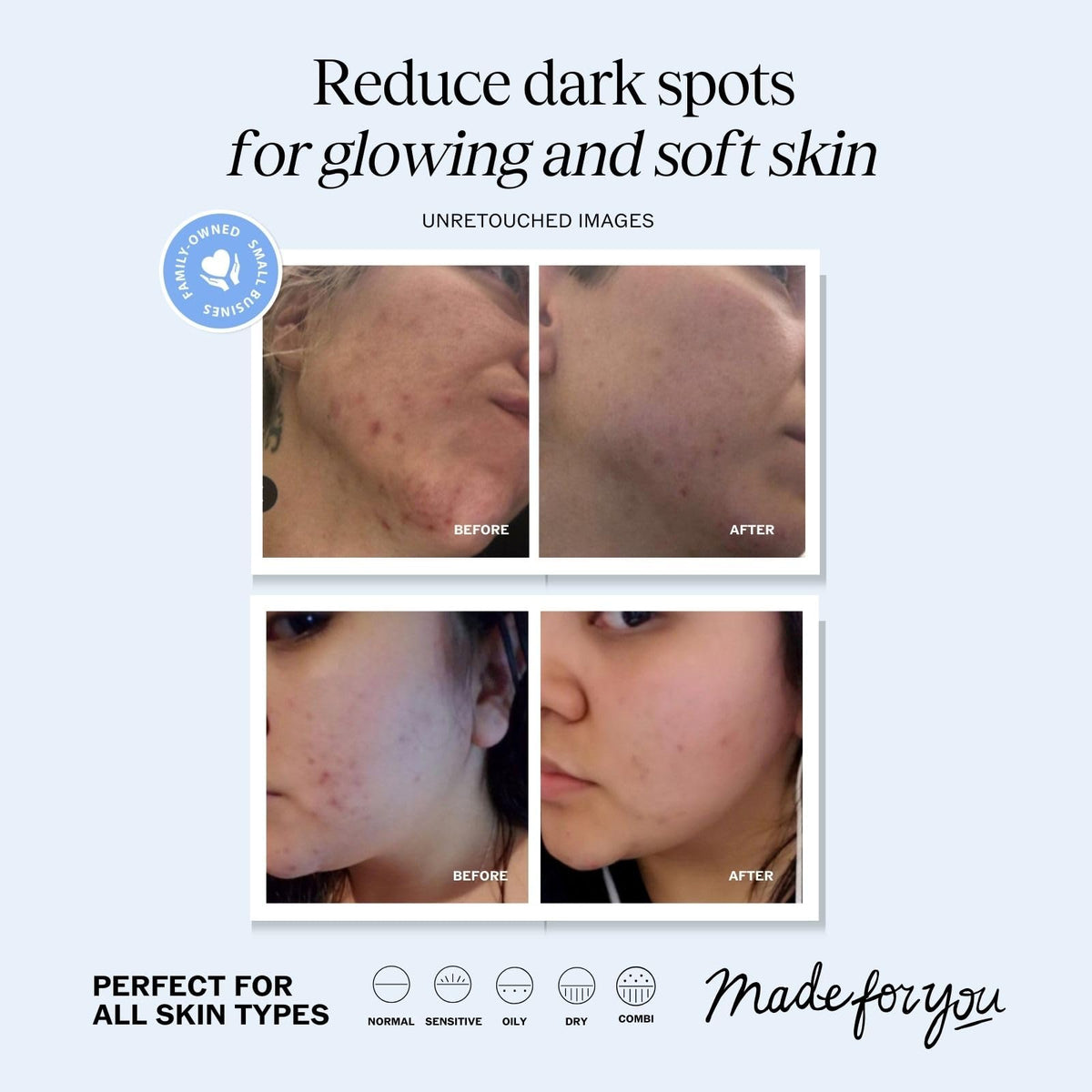 LilyAna Naturals dropper dispensing serum highlighting precise application