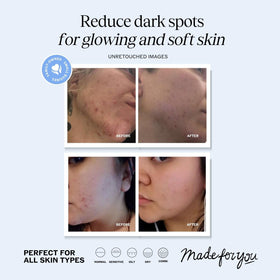 LilyAna Naturals dropper dispensing serum highlighting precise application