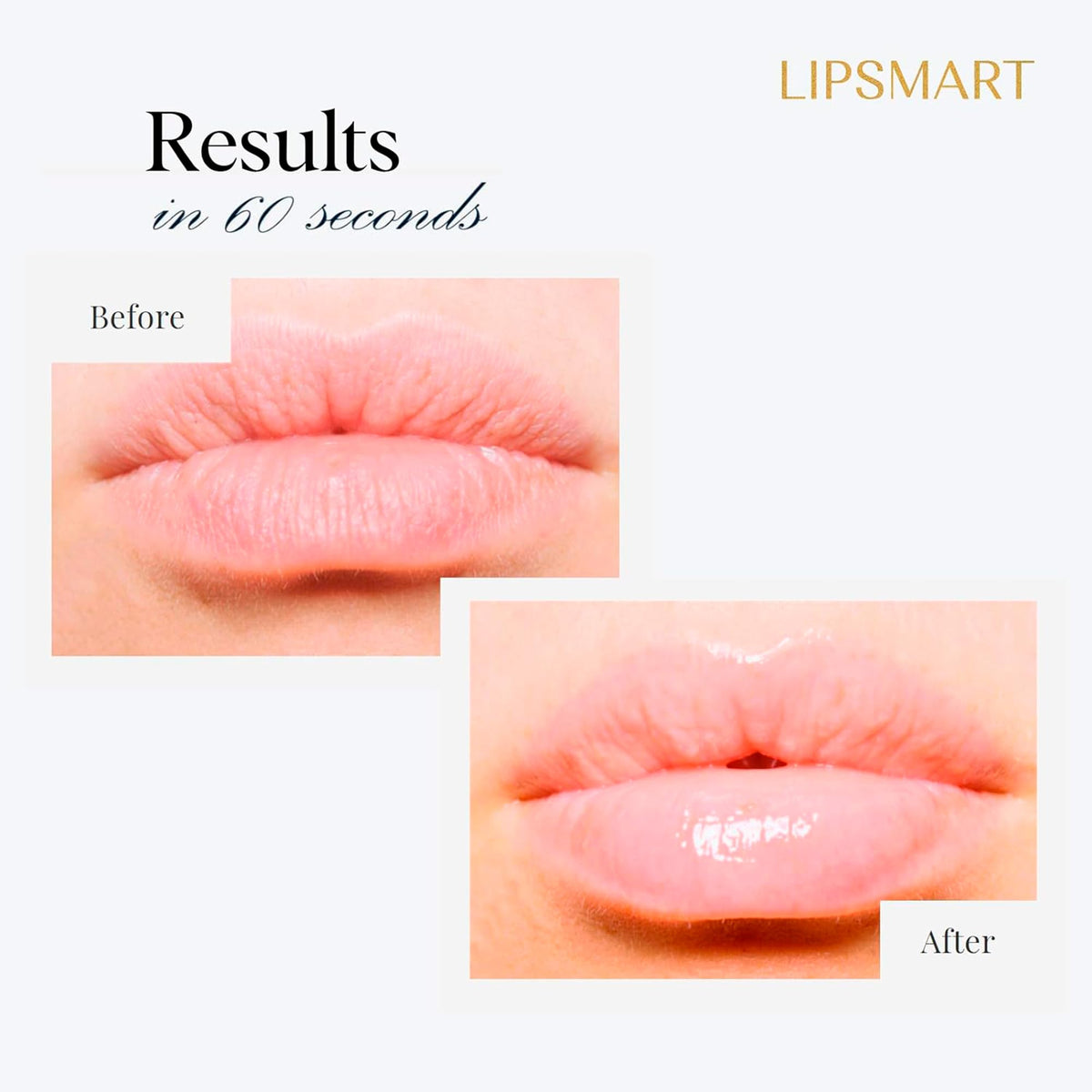 LipSmart before and after comparison highlighting fuller looking, smoother lips