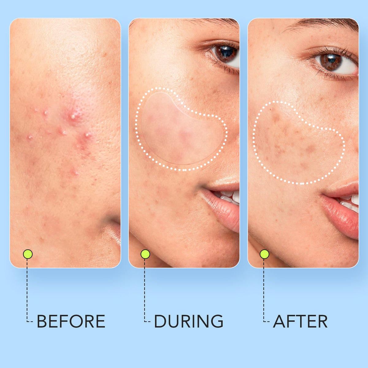 LitBear patch applied to forehead demonstrating discreet protection benefit