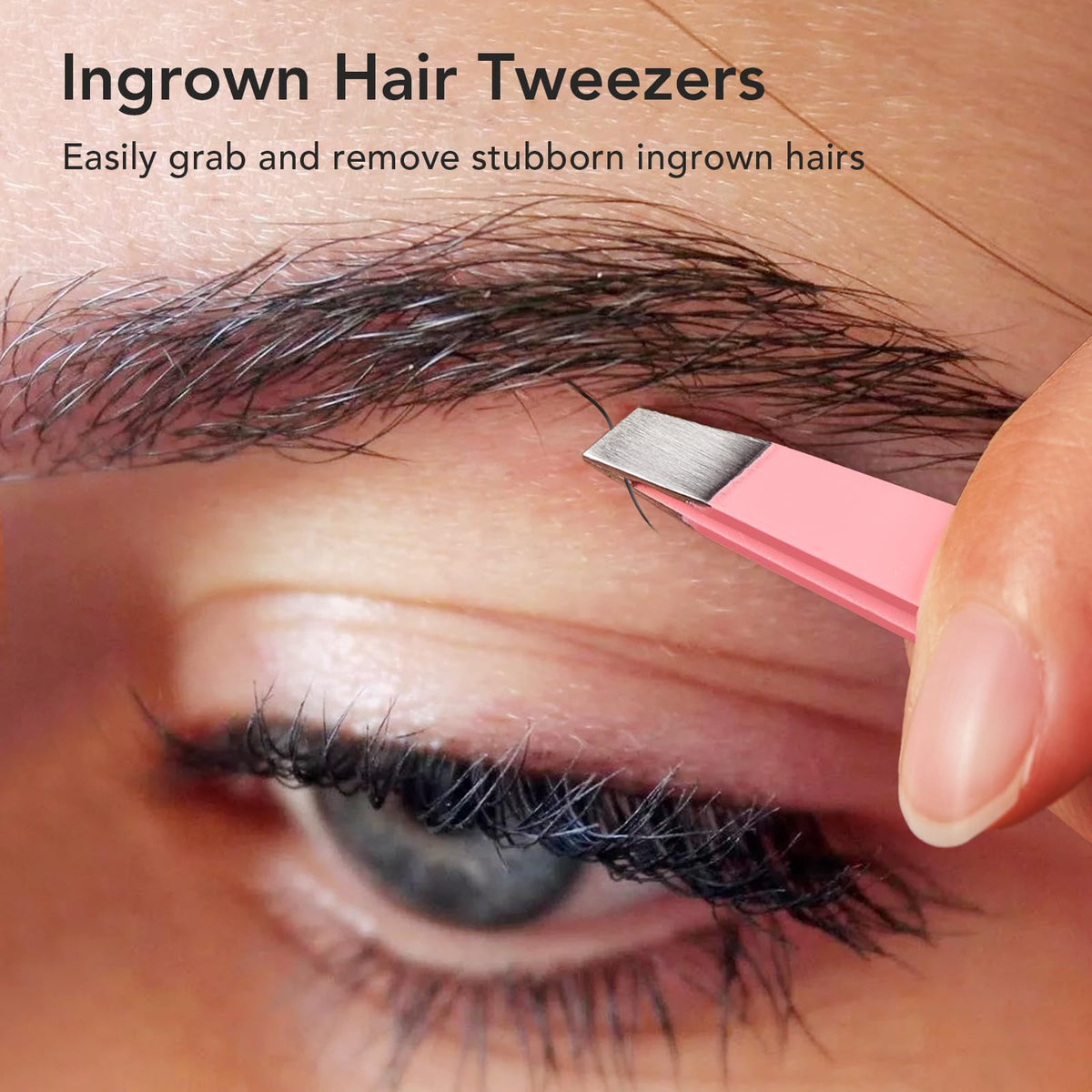 LitBear loop extractor detail highlighting fine loop, precise blackhead removal benefit