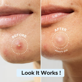LitBear patch on cheek demonstrating discreet coverage and protection