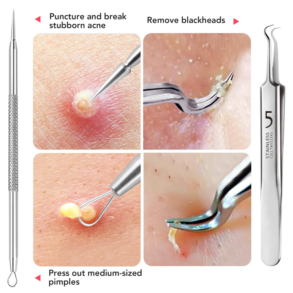 LitBear precision tweezers close focus removing ingrown hair, accurate grasping benefit