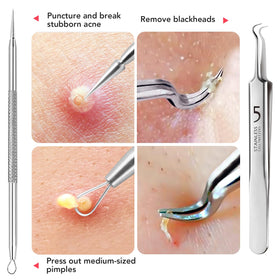 LitBear precision tweezers close focus removing ingrown hair, accurate grasping benefit