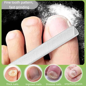 LJCKKGOSZ close-up of coarse file texture for quick thick-nail removal