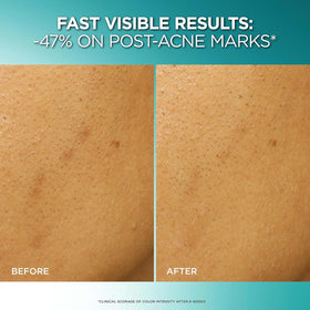 L'Oreal Paris close-up of exfoliant bottle tip for easy dispensing