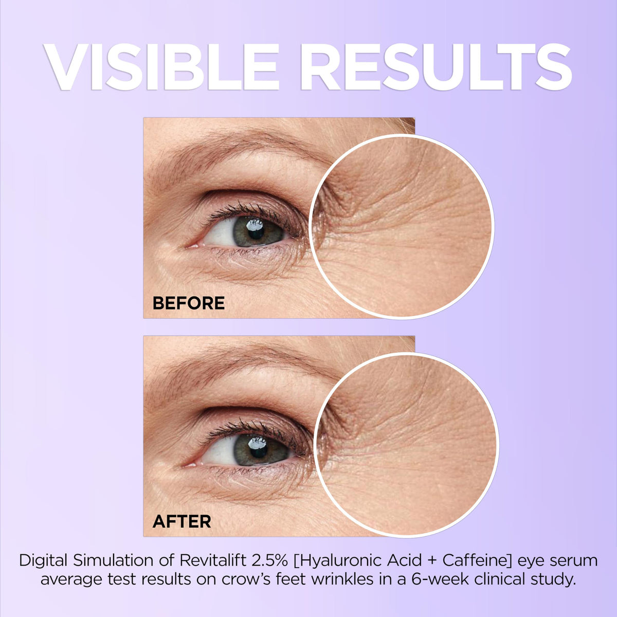 L'Oreal Paris eye serum held in hand to show 0.67 fl oz scale and portability