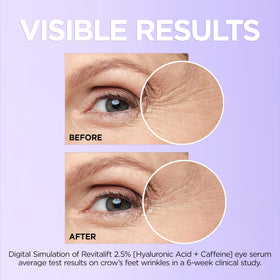 L'Oreal Paris eye serum held in hand to show 0.67 fl oz scale and portability
