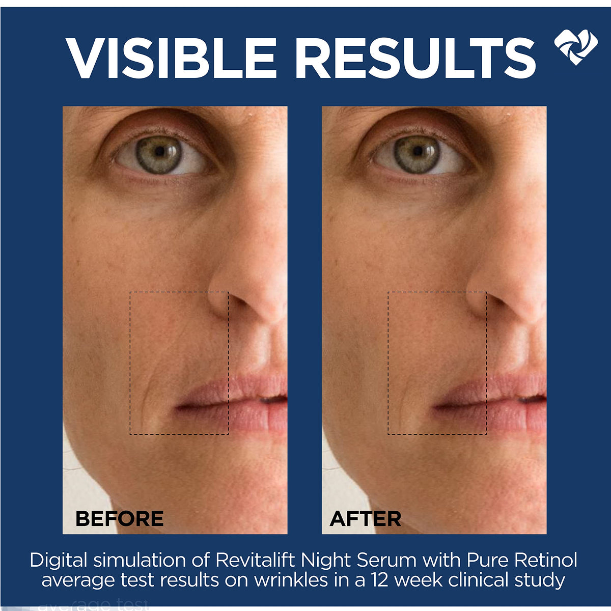 L'Oreal Paris serum applied on hand to show lightweight absorption benefit